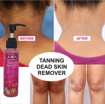 Tanning Dead Skin Remover